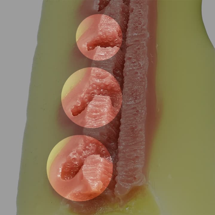 ケモモーンの仕掛け、スリットヒダ