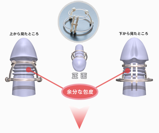 サフィット