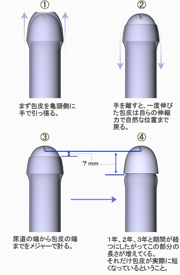 サフィット